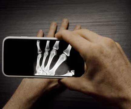 App That Mimics X-Ray Functionality on Your Smartphone